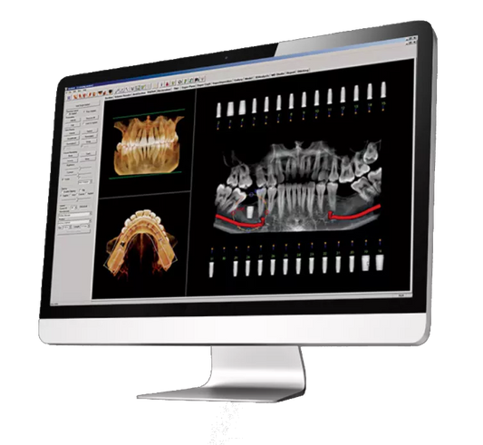 Osteoid Software Options